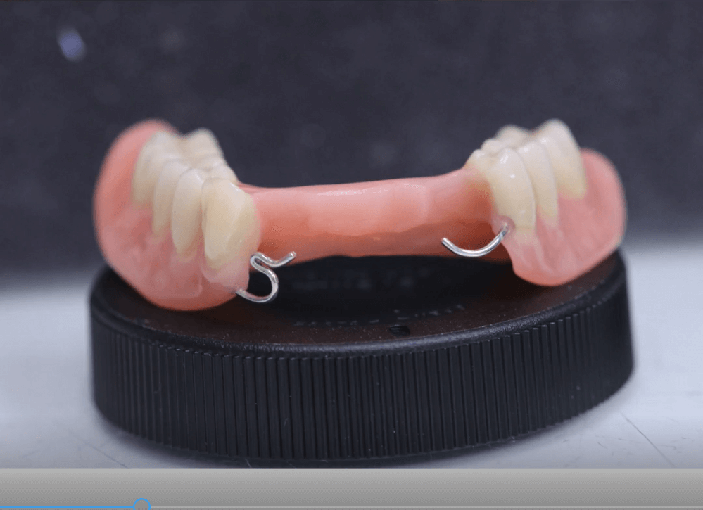 Лечение и протезирование зубов в рассрочку в екатеринбурге