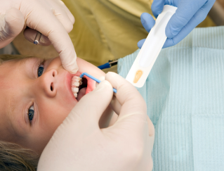 Фторирование молочных и постоянных зубов